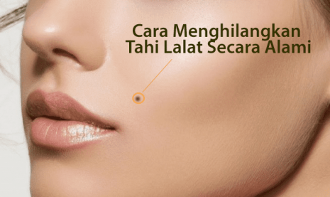 Cara Menghilangkan Tahi Lalat