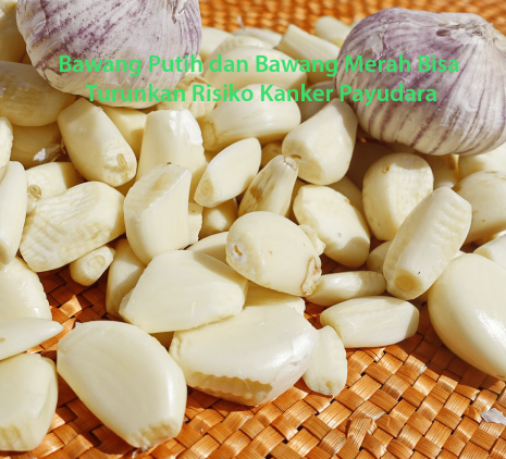 Bawang Putih dan Bawang Merah Turunkan Risiko Kanker Payudara